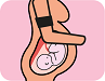 Icono Programa de cribado prenatal de preeclampsia