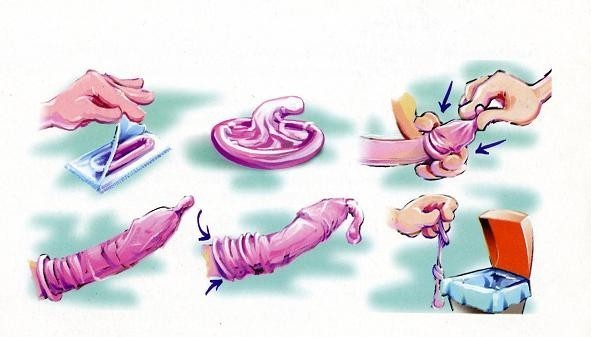 Colocaci&oacute;n preservativo externo