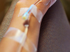Imagen de flickr Brazo