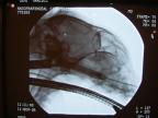 stent flickr