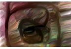 lna_lna artelista
