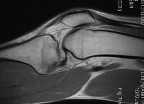 Flickr Tac de rodilla