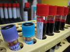 Imagen de Flickr Muestras de sangre