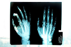 Imagen de Flickr Radiografía de una mano