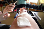 Extracción de sangre