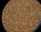 Imagen Glóbulos rojos muestra de glóbulos rojos