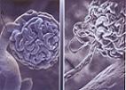 glomerulo Personal