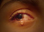 dolor flickr